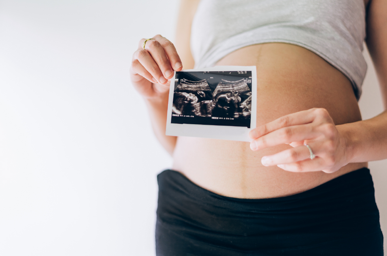 Test Prenatal No Invasivo